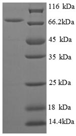 E. coli speA protein
