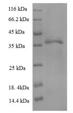 Human HLA-B protein