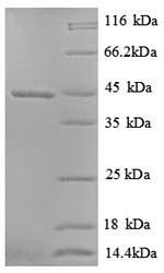 Doublecortin protein