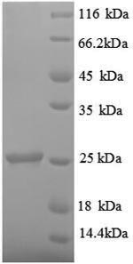 Rat TIMP1 protein