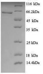 Human KAT5 protein