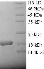 Rat alpha 2 Macroglobulin protein