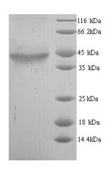 Human ADH5 protein