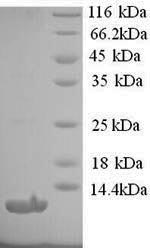 Human AGTR1 protein