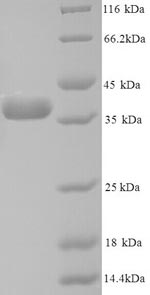 Human ANXA5 protein