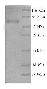 Human AP2M1 protein