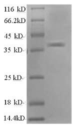 Human APEX1 protein