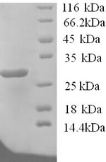 Human ATP4B protein