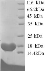 Dog BCHE protein