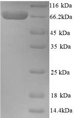 Human BCHE protein