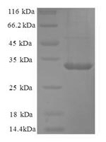 Human CA12 protein