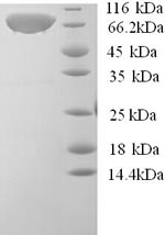 Human CAST protein