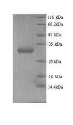 Human CBX7 protein