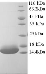 Human CCNJL protein