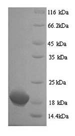 Human CLTCL1 protein