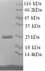 Collagen I protein