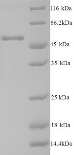 Human CSNK1E protein