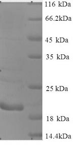 Human CTAG1A protein