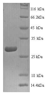 Human CTSK protein