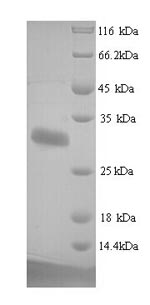 Human DLK1 protein