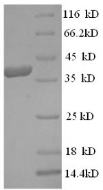Human EIF4G1 protein