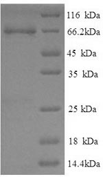 Pig ETFDH protein