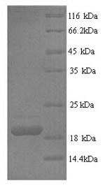 Human FASLG protein