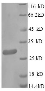 Human FCGRT protein