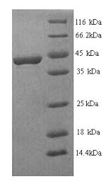 Human FGFR3 protein