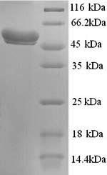 Human GALNS protein
