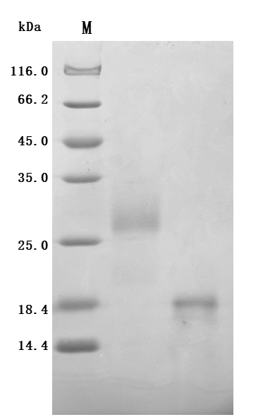 Human GLP1R protein
