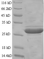 Mouse Gpc4 protein