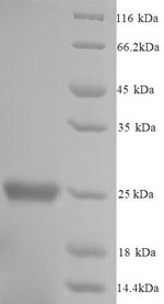 Mouse Gstp1 protein