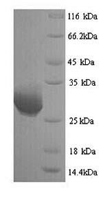 Human GZMB protein