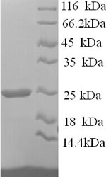 Human HAVCR2 protein