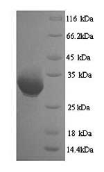 Human HNRNPA2B1 protein