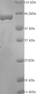 Human IDO2 protein