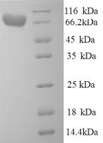 Human IDUA protein