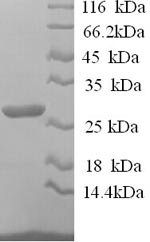 Sheep IL12B protein