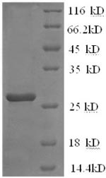 Mouse Il2rb protein