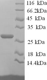 Human JAM2 protein