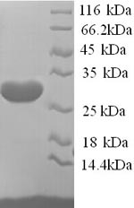 Human KCND2 protein