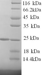 Human KLK7 protein