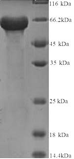 Human KRT14 protein