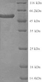 Human KRT4 protein