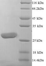 Yeast LILRA5 protein
