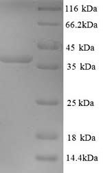 Mouse Map2 protein