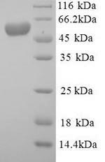 Mouse Mdm2 protein