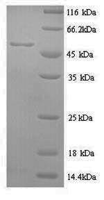 Human METAP2 protein