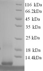 Human MT1F 1F protein